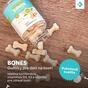 3x BONES - Gumíky na kosti pre deti
